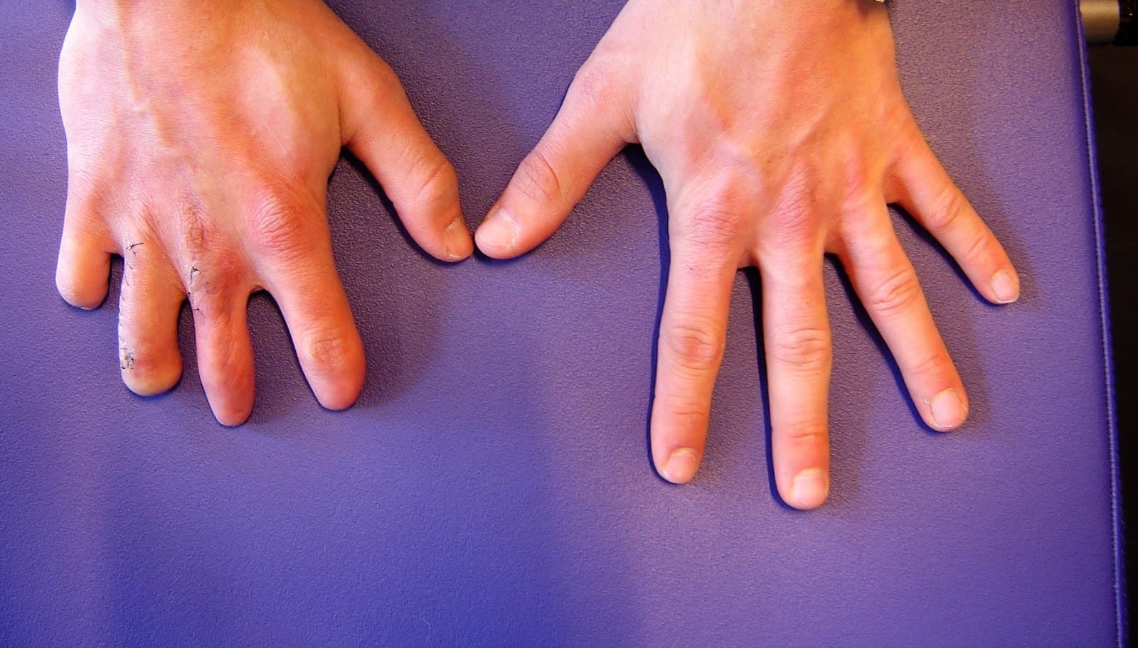 hand-1.jpg